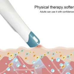 Skadedjur & Insekter-pc bite away - Den ursprungliga elektroniska behandlingen för myggbett. Utan kemikalier - Behandling med värme{hh}